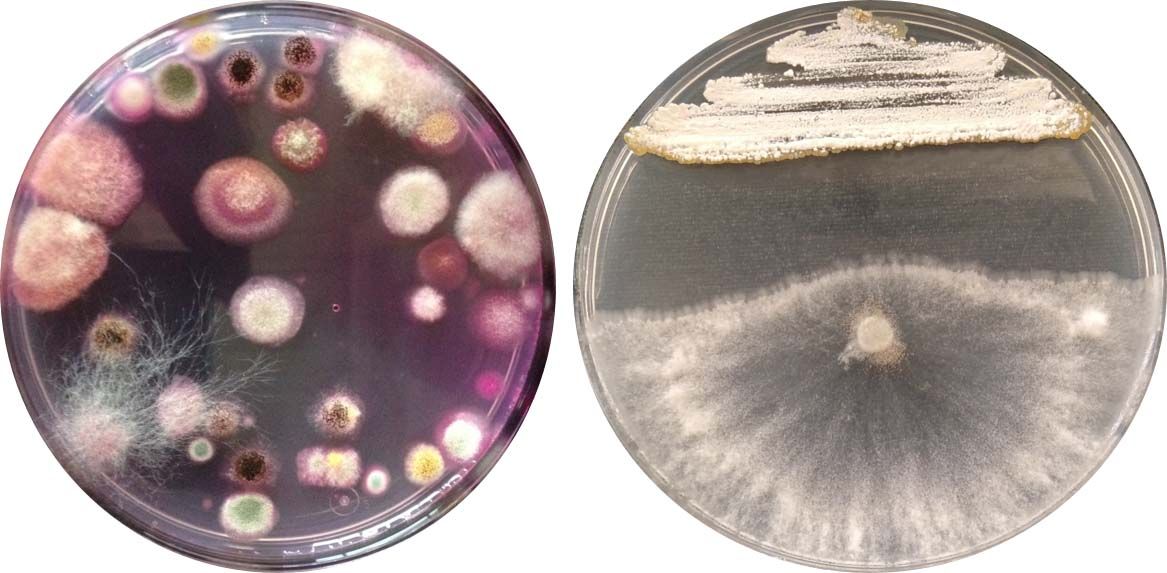 Microbiota fúngica de un suelo agrícola