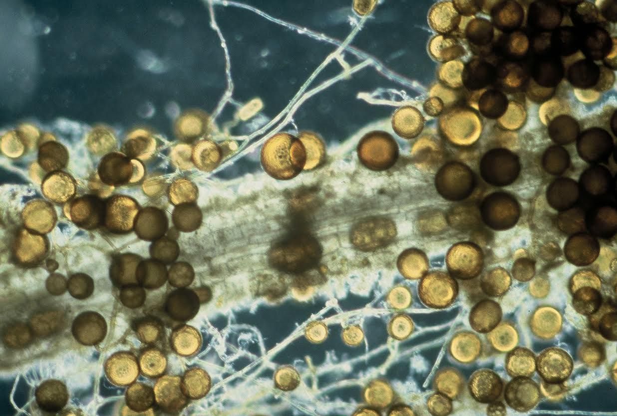 Imagen microscópica que muestra Micorrizas 