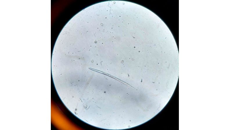 M. incógnita observado al microscopio. Fuente: AINIA.