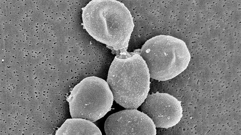 Imagen al microscopio electrónico de la levadura Saccharomyces cerevisiae durante el proceso de envejecimiento del cava. / IATA-CSIC