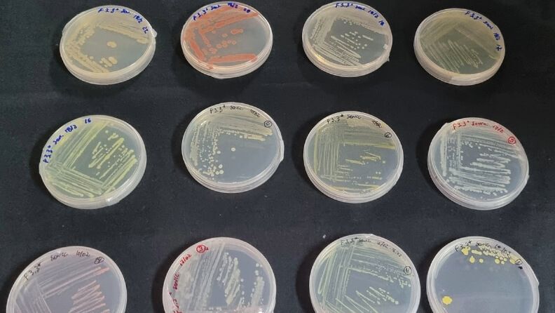 Ejemplos de bacterias aisladas.