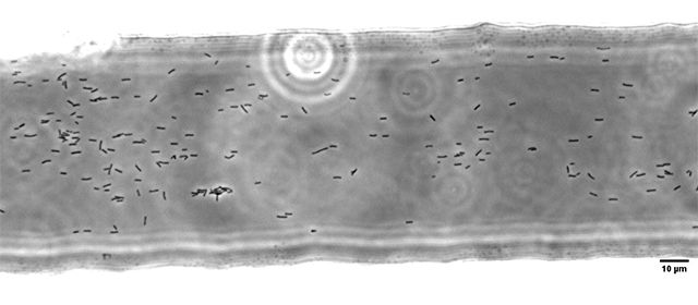 Cámaras de microfluídica que simula los haces del xilema para el estudio de producción de biofilm, adhesión y el movimiento de aislados de Xylella fastidiosa. Nótese las células bacterianas en el interior de la misma (fuente: María Pilar Velasco Amo, CSIC)