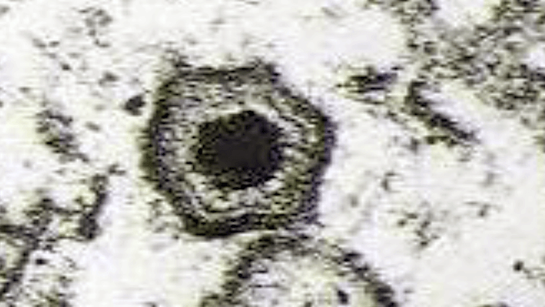 Foto 1: El virus de la PPA por micrografía electrónica. 